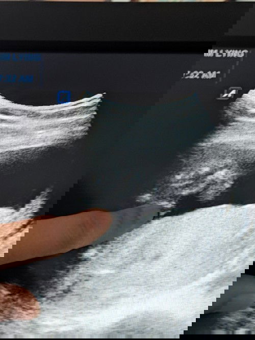 Mas malaki inunan kesa sa baby