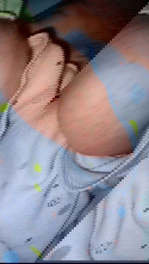 Bintik2 merah d badan bayiku