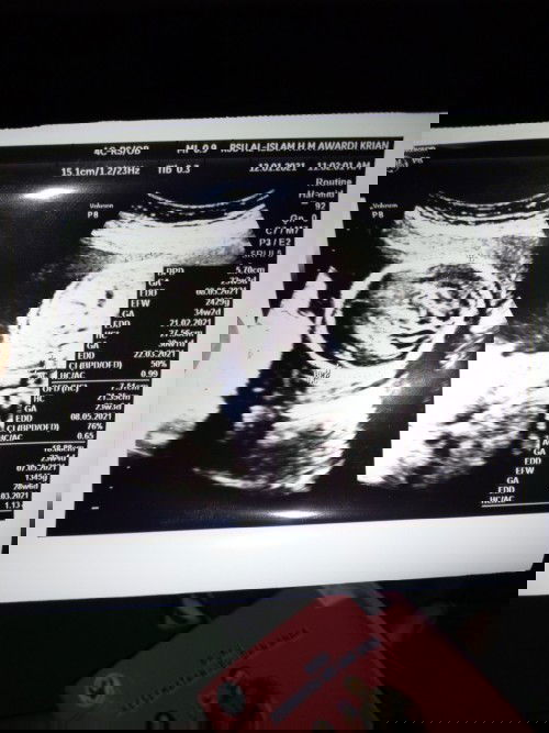 Tanya cara membaca hasil USG