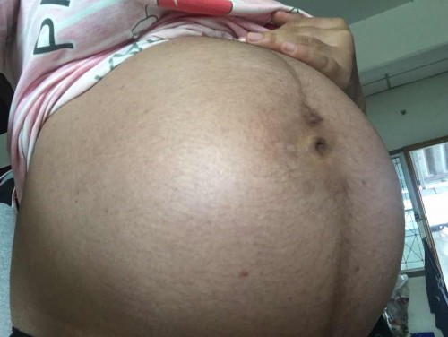 8เดือนเเล้วยังไม่รู้เพศเลย