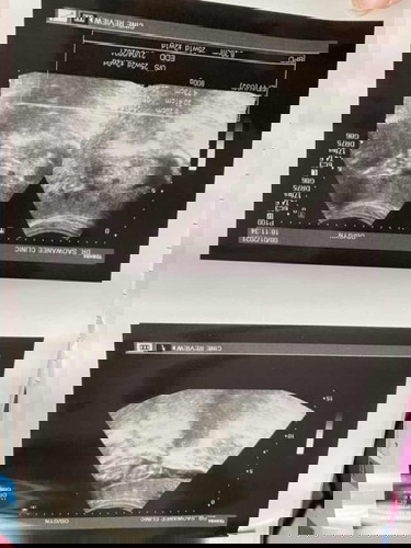 ขอดู แม่ๆเดือนเมษาหน่อยค่ะ ถึงไหนกันแล้ววว 🥰