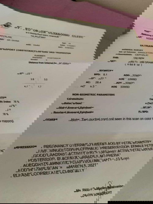 Two Nuchal Cord Coil