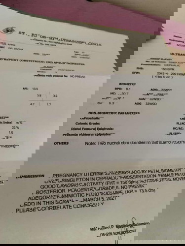 Two Nuchal Cord Coil