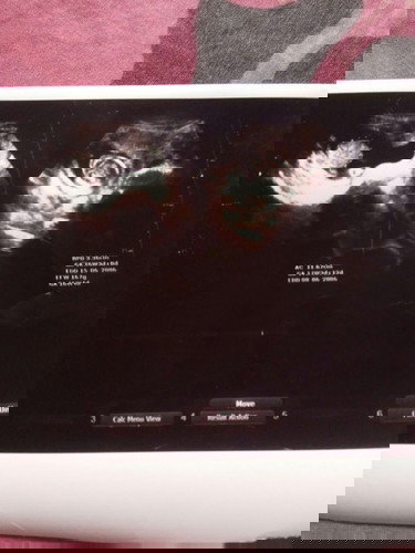 Hamil berapa bulan kita merasakan bayi gerak