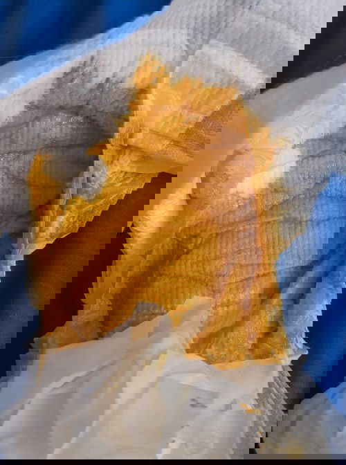 อึแบบนี้ผิดปกติมั้ยคะ