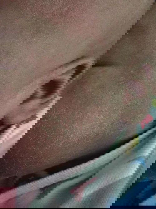 น่าแห้งลอก????