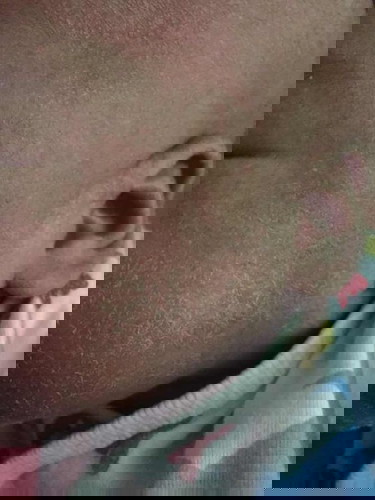 น่าแห้งลอก????