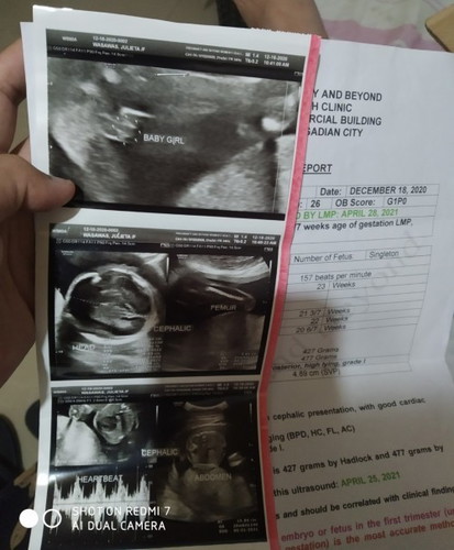 Mga mamsh ask klang ng kakamali va yong ultra sound 2times na ako ng oa gender nung 18 weeks