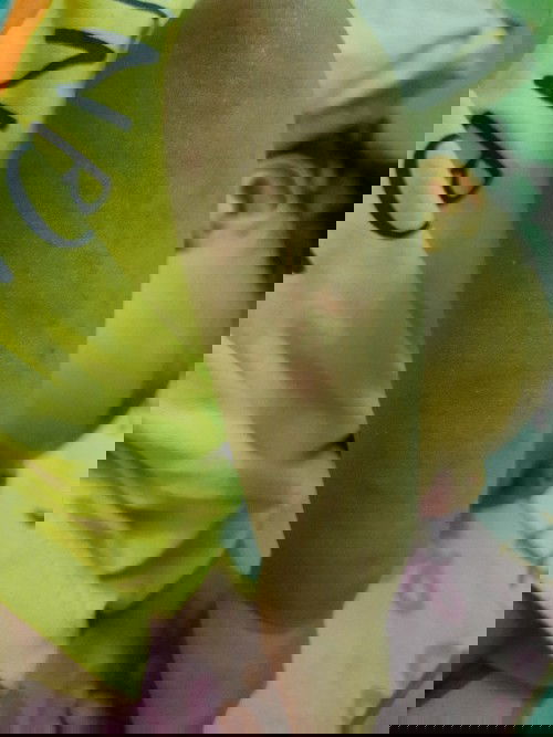 Merah merah di kulit