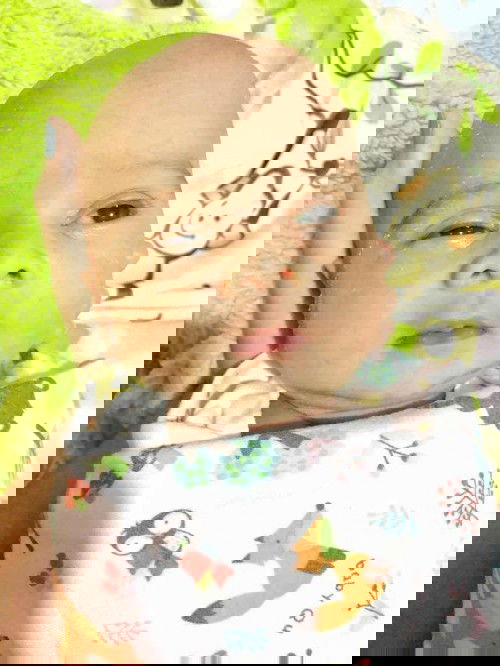 Mata bayi susah buka