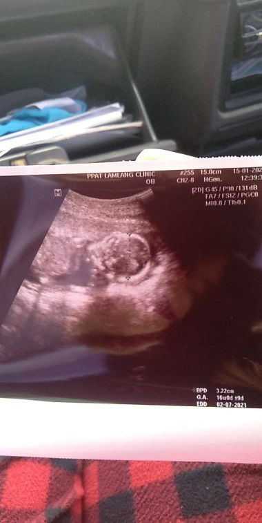 พ่อชื่อ เติร์ท
แม่ชื่อ อ้อม
ลูกชื่ออะไรดีคะ (ยังไม่รุ้เพศ)