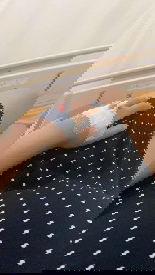 Mohon doanya saya mau operasi SC dengan plasenta akreta