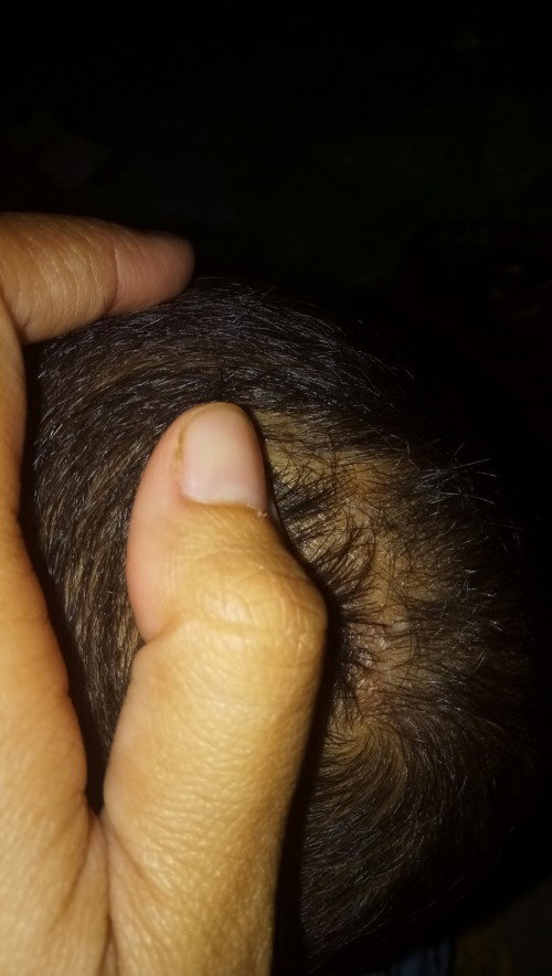 kulit kepala anak