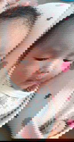 ขลิปพังผืดใต้ลิ้น