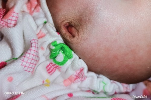 สะดือลูก