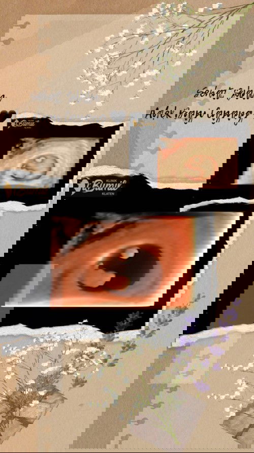 Usia 8 minggu USG dari Miss V bunda. Alhamdulillah sehat sehat 😇