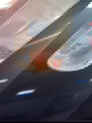 แท้งคุกคาม...สู่การแท้งจริง ตัวอ่อนไม่สมบูรณ์ ถุงตั้งครรภ์เล็ก