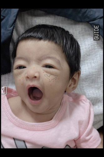หนูน้อยผมดก