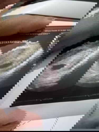 Baka po pwede magpa basa.