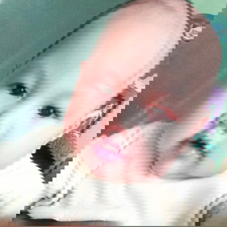 Susah pup karna mpasi