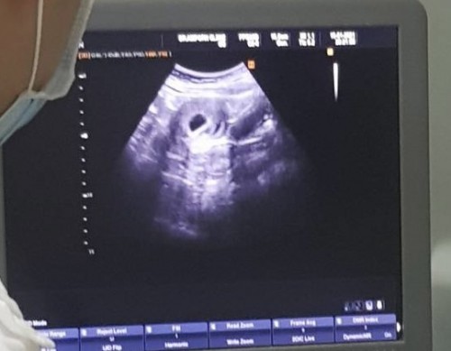 มีคำถามจากแม่มือใหม่ท้องแรกค่ะ