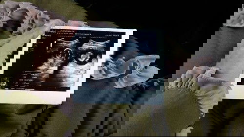 Hasil USG kemarin bunda