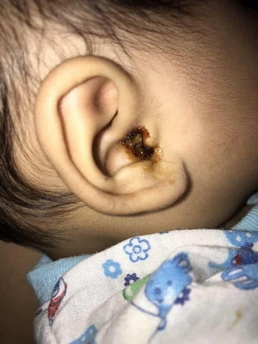 หูของน้องเป็นแบบนี้