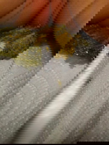 น้อง 1 เดือน อึแบบนี้ ควรพาหาหมอเลยมั้ยคะ🙏🏻