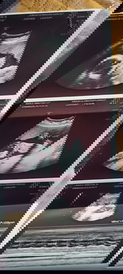 LORD 🙏 SANA MAISILANG KO ANG ANAK KO NA MALUSOG, NORMAL AT WALANG SAKIT🙏🙏🙏 PLEASE PO!