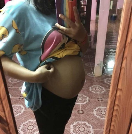 ท้องเเค่นี้เล็กไปไหมค่ะ