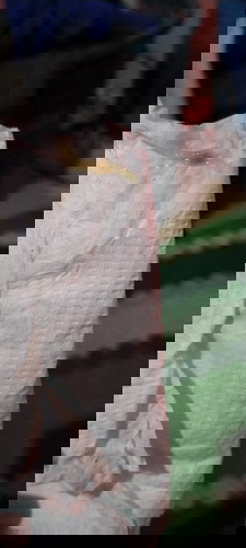 yellowish brown discharge