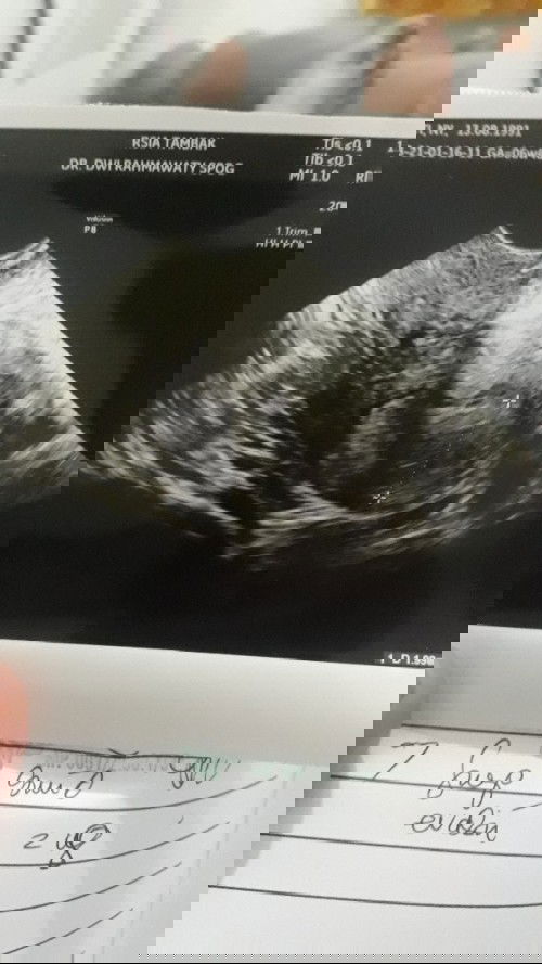 Janin Belum Terlihat