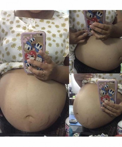 34w อยากรู้เพศน้องจัง