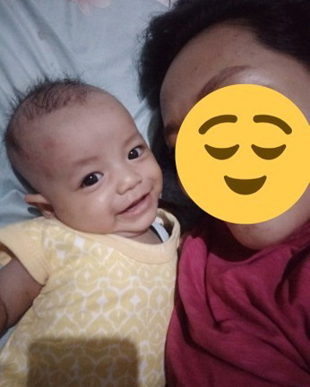 Anak kurang gizi