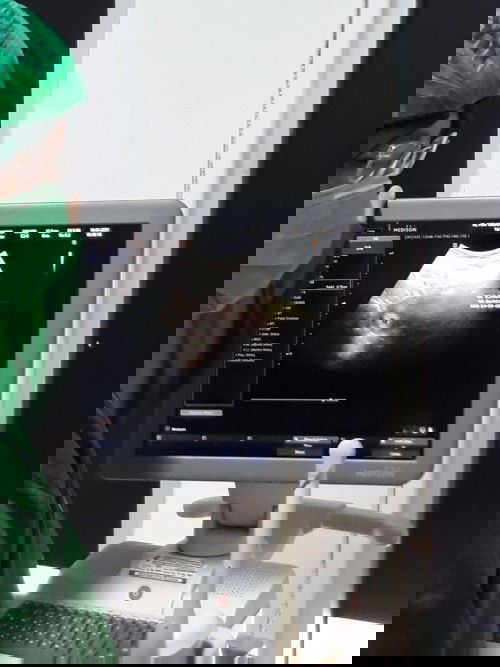 Usg perdana minggu ke 5