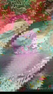 wajah bayi belangbelang