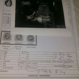 Apa iya perut buncit ke depan menandakan jenis kelami  laki2 sedangkan hasil usg nya perempuan :(