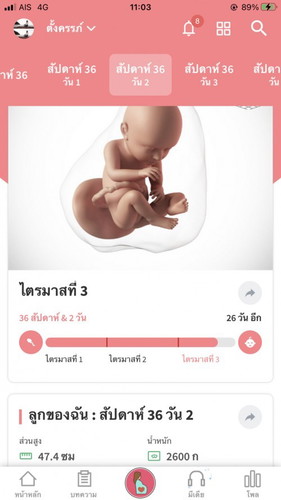 ตื่นเต้นจัง นัดผ่าครั้งแรก