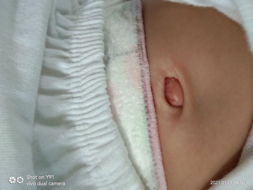 Pa help naman po. 3months na si lo