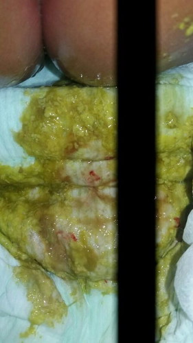 Baby bab cair ada darahnya dikit