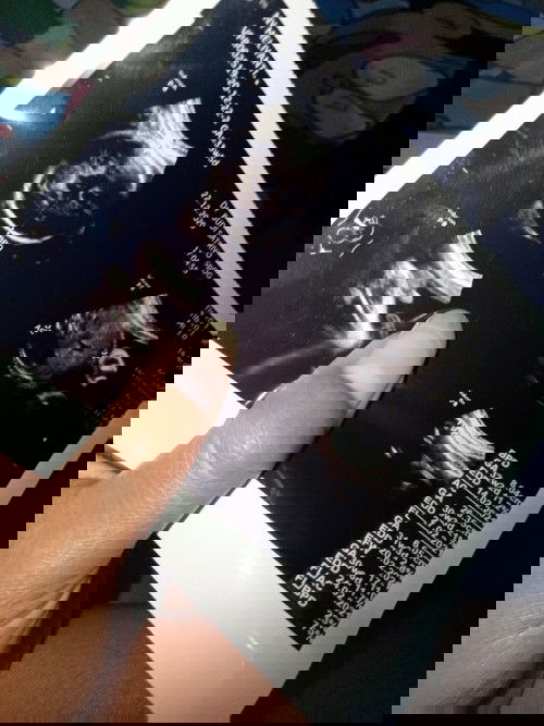 Ada Yang Bisa Baca Hasil USG?