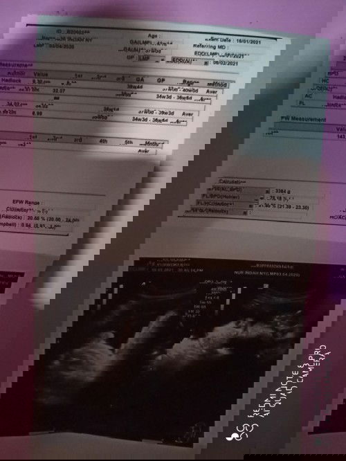 Hpl bidan beda dengan hpl usg