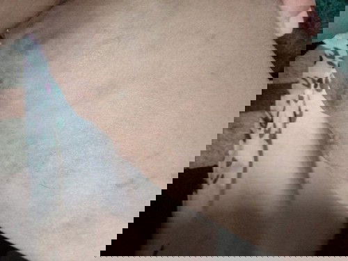 Varisses sampai dinding vagina