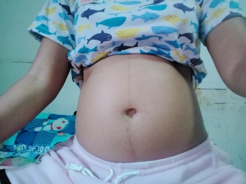 ท้องออกกันไหม