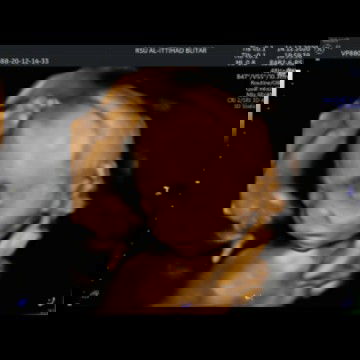 HARAPAN BARU DITAHUN YANG BARU