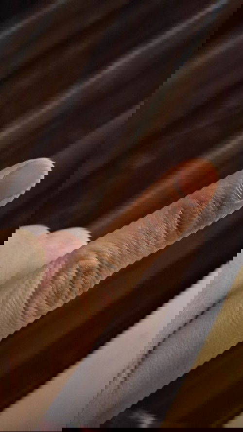 kulit super kering dan gatal😭