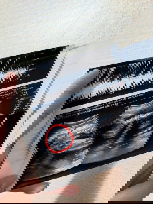 PUTUTOY BA YUN? 😁