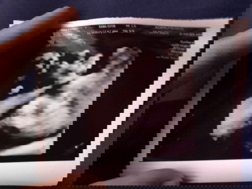 Scan baby tapi babynya malu.