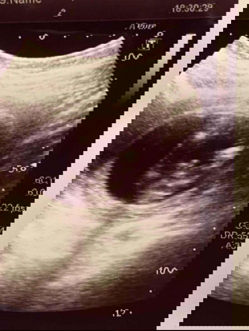 ความรู้สึกของคำว่า “ความสุข”