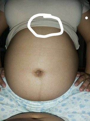 Masakit sa upper abdomen